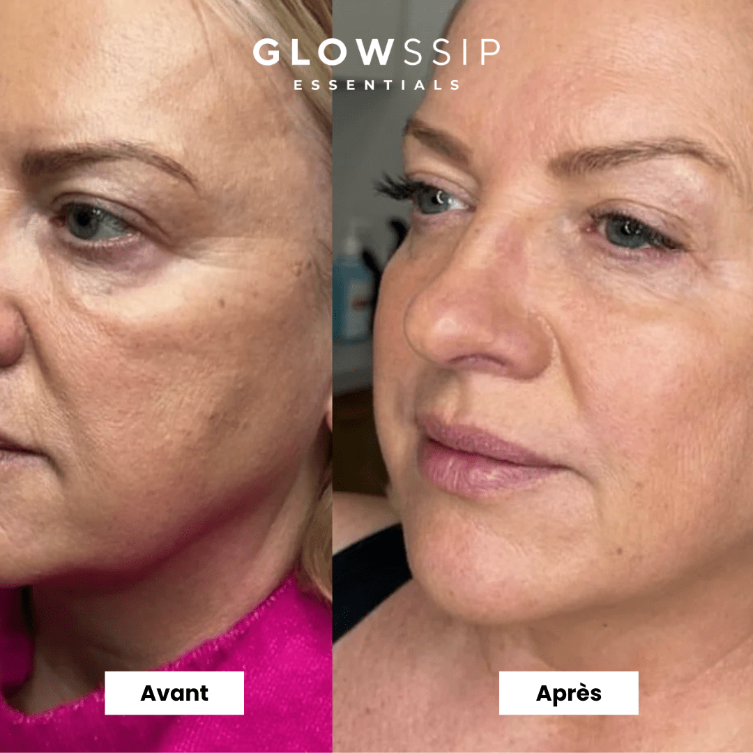 Masque Bio-Collagène®
