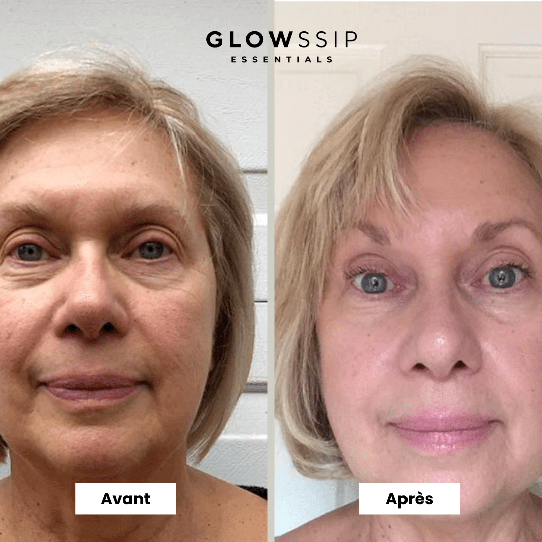Masque Bio-Collagène®
