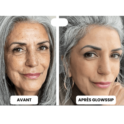 Micro Infusion 3 Mois + 2 Cadeaux Offerts
