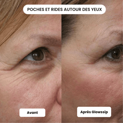 Micro Infusion 3 Mois + 2 Cadeaux Offerts