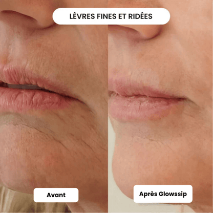 Micro Infusion 3 Mois + 2 Cadeaux Offerts