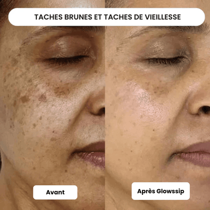 Micro Infusion 3 Mois + 2 Cadeaux Offerts