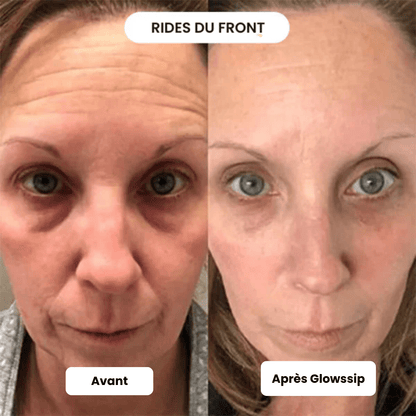Micro Infusion 3 Mois + 2 Cadeaux Offerts