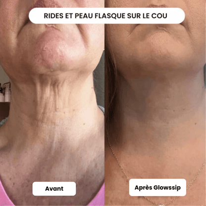 Micro Infusion 3 Mois + 2 Cadeaux Offerts