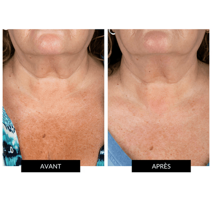 Masque cou et décolleté Micropeptides229®