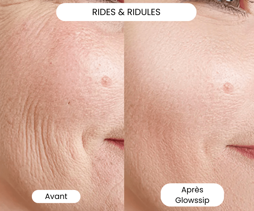Micro Infusion: -65% +4 Cadeaux Offerts Aujourd&