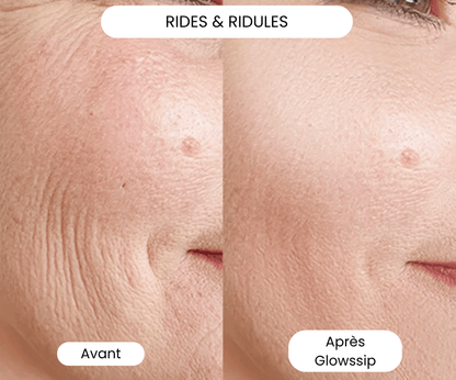 Micro Infusion: -65% +4 Cadeaux Offerts Aujourd&