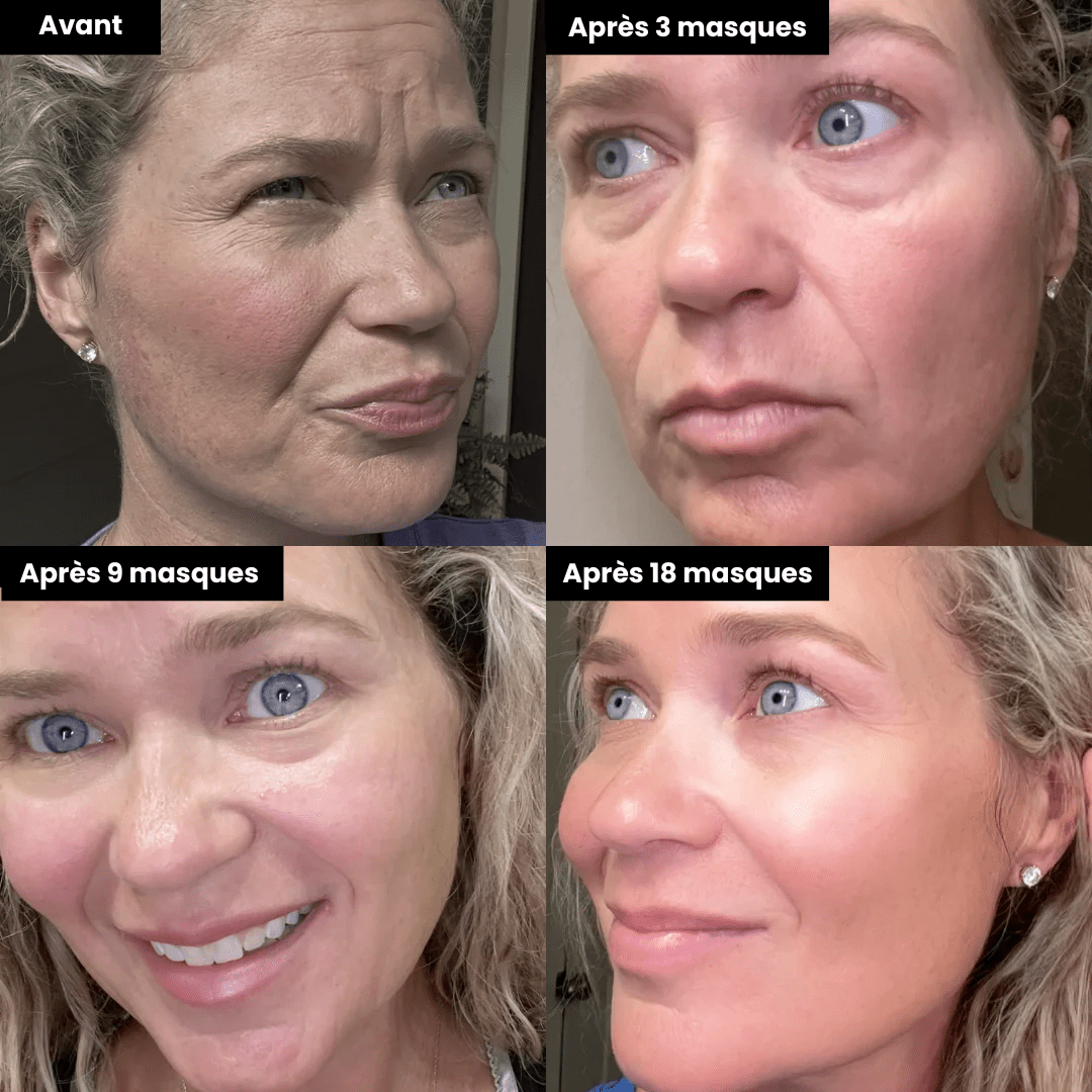 Masque Bio-Collagène®