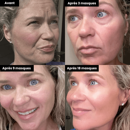 Masque Bio-Collagène®